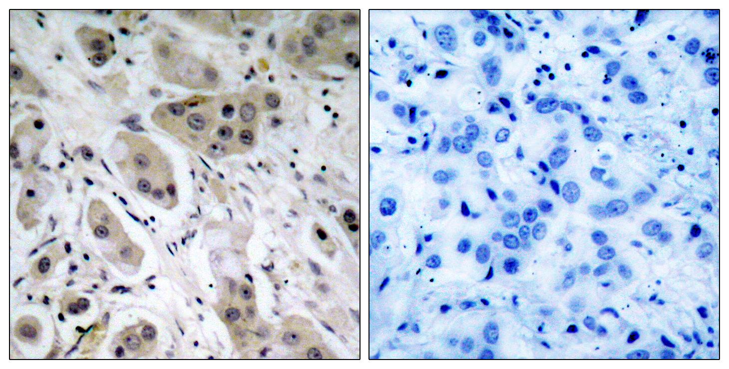 Akt (Phospho-Ser473) Antibody
