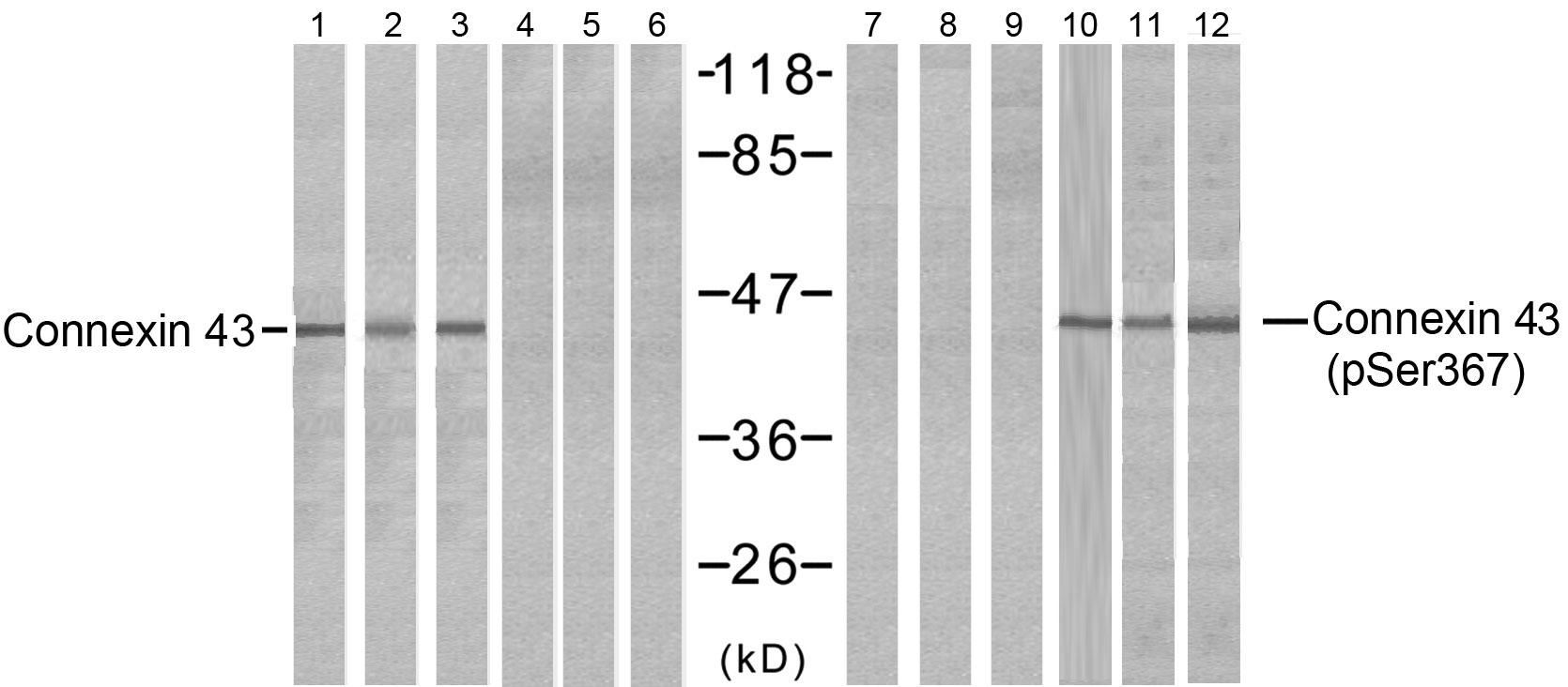 Western blot analysis of extracts from HeLa (Line 1, 4, 7 and 10), K562 (Line 2, 5, 8 and 11) and 293 (Line 3, 6, 9 and 12) cells, untreated or treated with PMA (1ηM 30min), using Connexin43 (Ab-367) antibody (E021250, Lane 1, 2, 3, 4, 5 and 6) and Connexin43 (phospho-Ser367) antibody (E011258, Lane 7, 8, 9, 10, 11 and 12).