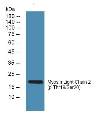Western blot analysis of lysates from SW480 cells, primary antibody was diluted at 1:1000, 4° over night.