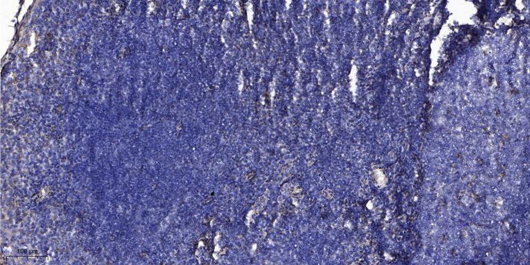 Immunohistochemical analysis of paraffin-embedded human tonsil. 1, Antibody was diluted at 1:200 (4° overnight). 2, Tris-EDTA, pH9.0 was used for antigen retrieval. 3,Secondary antibody was diluted at 1:200 (room temperature, 30min).