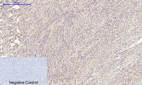 Immunohistochemical analysis of paraffin-embedded Human-uterus tissue. 1,TIMP-1 Polyclonal Antibody was diluted at 1:200 (4°C,overnight). 2, Sodium citrate pH 6.0 was used for antibody retrieval(>98°C,20min). 3,Secondary antibody was diluted at 1:200 (room temperature, 30min). Negative control was used by secondary antibody only.