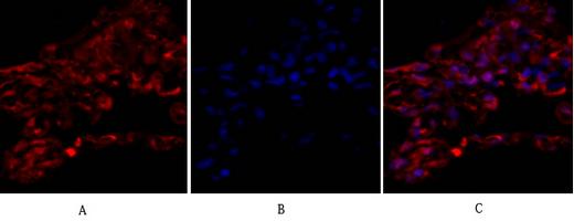 Immunohistochemical analysis of paraffin- Immunofluorescence analysis of human-lung tissue. 1,Tubulin α embedded Human-uterus tissue. 1,Tubulin α Polyclonal Antibody(red) was diluted at 1:200(4°C,overnight). 2, Cy3 Polyclonal Antibody was diluted at 1:200 labeled Secondary antibody was diluted at 1:300(room temperature, (4°C,overnight). 2, Sodium citrate pH 6.0 was used 50min).3, Picture B: DAPI(blue) 10min. Picture A:Target. Picture B: for antibody retrieval(>98°C,20min). 3,Secondary DAPI. Picture C: merge of A+B antibody was diluted at 1:200(room temperature, 30min). Negative control was used by secondary
