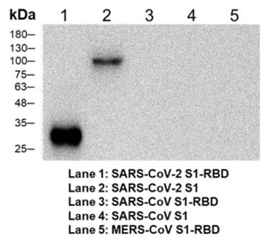 Western blotting analysis of Mouse anti -SARS-CoV-2 Spike mAb, Clone Storage: Storage at - 20 ℃ for 1 year and avoid repeated freezing and Recommended dilution ratio and final concentration for product