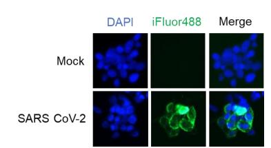Immunofluorescence analysis of Mouse anti -SARS-CoV-2 Spike mAb, Clone LGSV201 (1:1000).